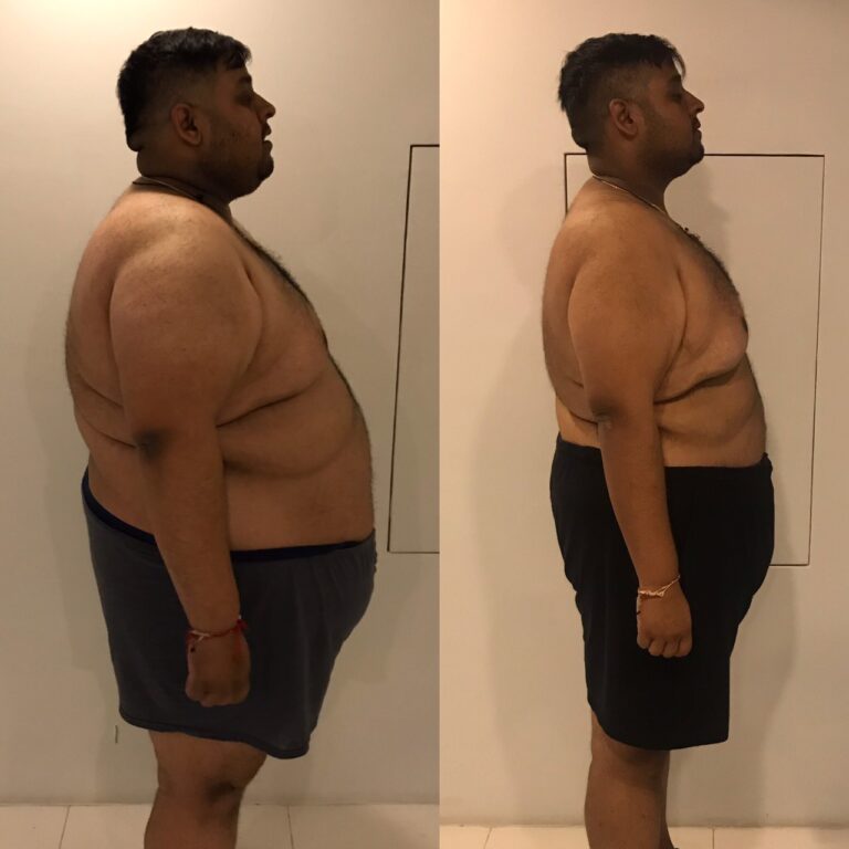 Joakim lost 52 kg with us