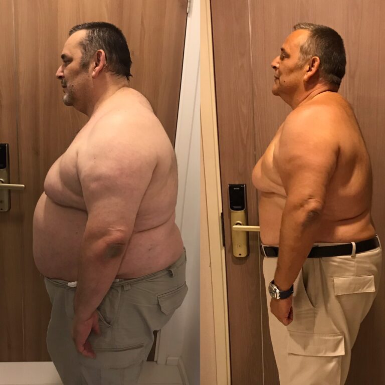 Johnny.K lost 30 kg with us