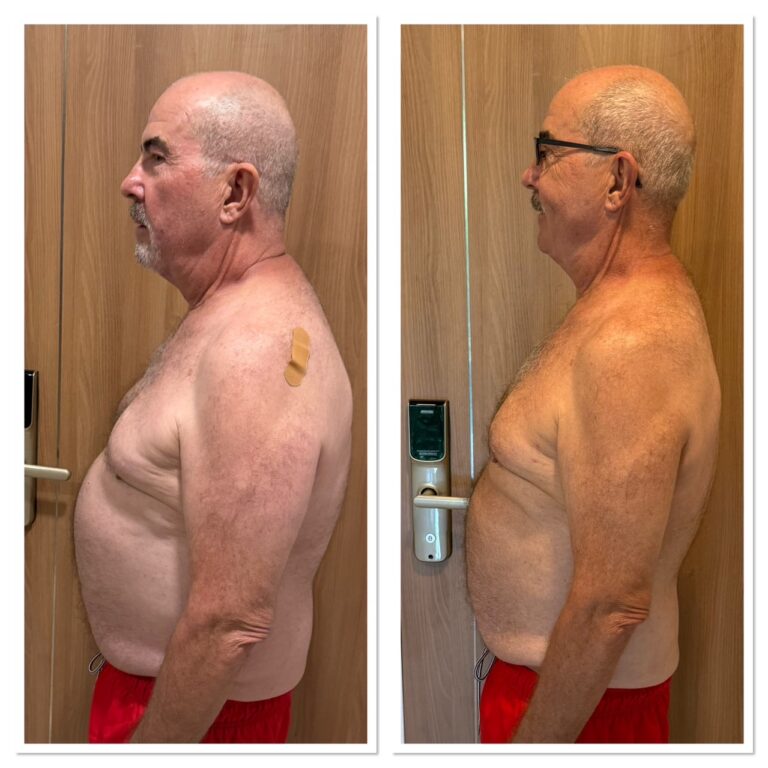 Charles lost 12 kg with us